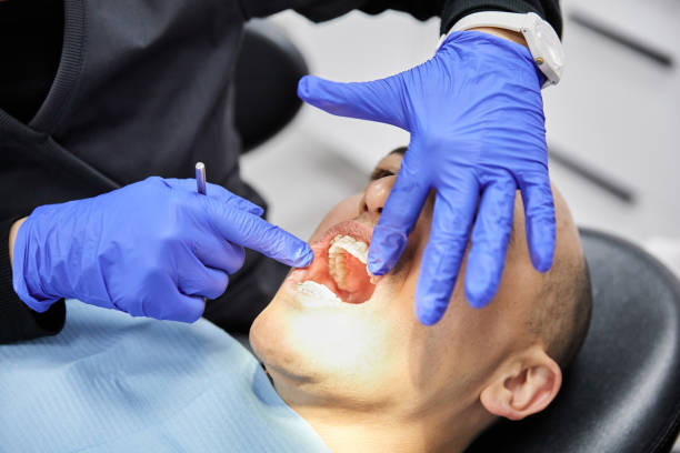 Best Emergency Dentist for Lost Fillings or Crowns in Hershey, PA