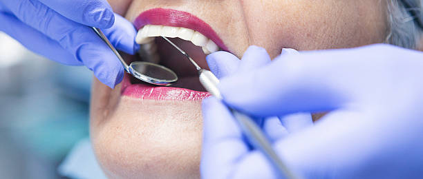 Best Emergency Dental Services for Seniors in Hershey, PA